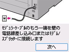 かんたんセットアップ画面：次へを選択